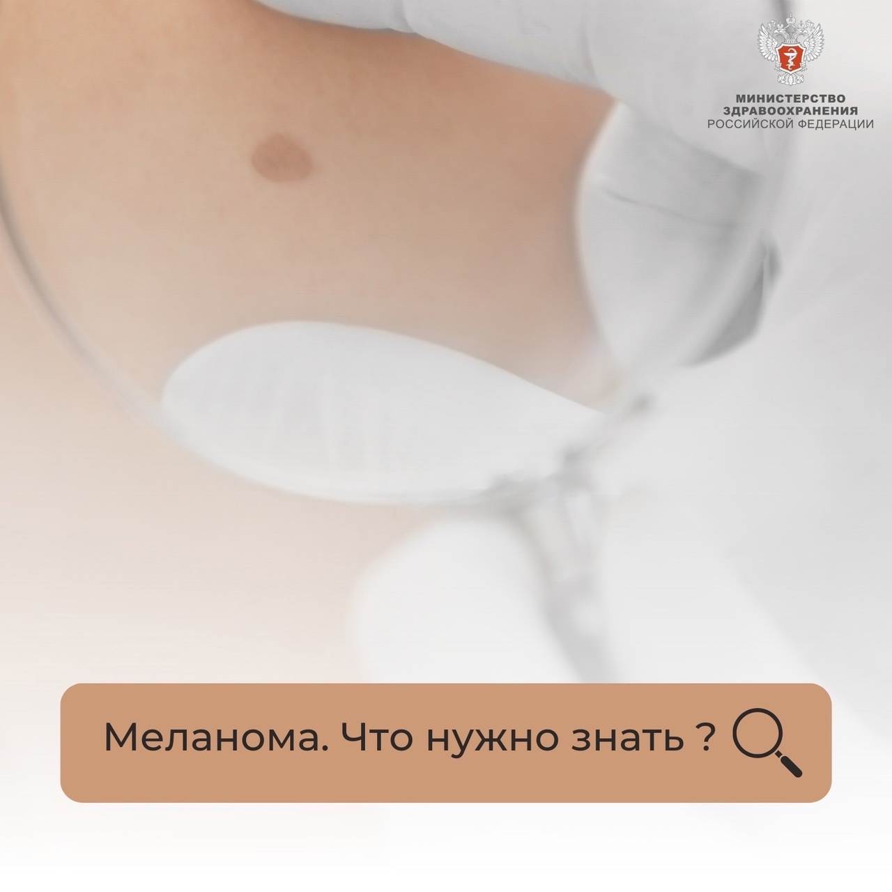 Время информации о меланоме. Что нужно знать?