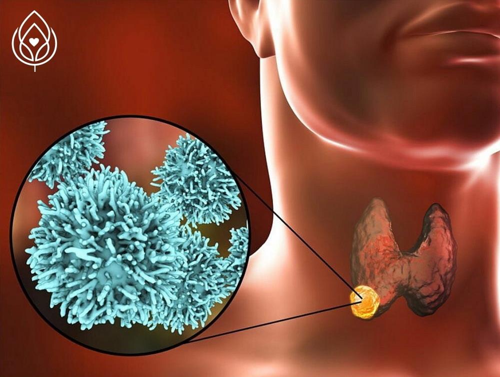 Щитовидная железа  