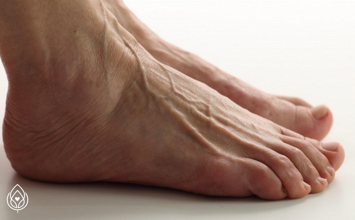 Диабетическая стопа